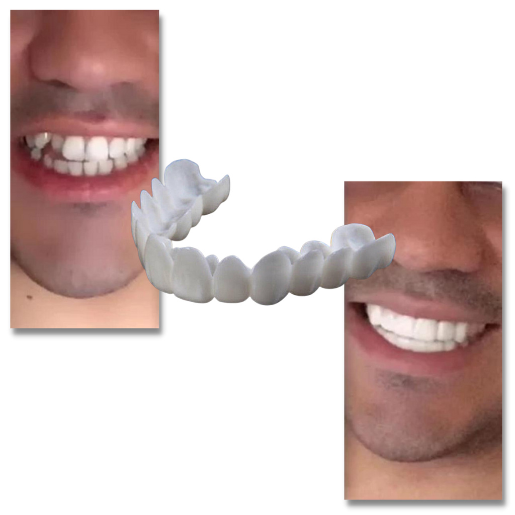 Couverture dentaire sourire parfait - gouttière confortable