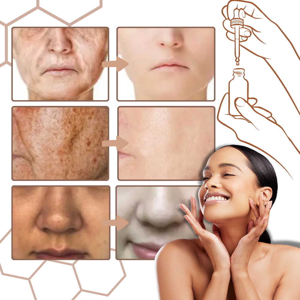 Sérum facial correcteur non gras à la mélanine