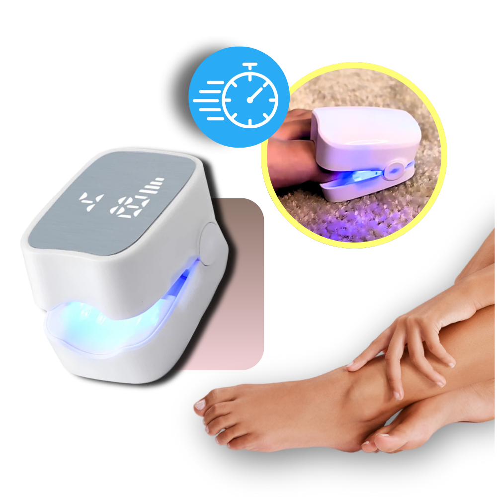Laser indolore pour les mycoses des ongles