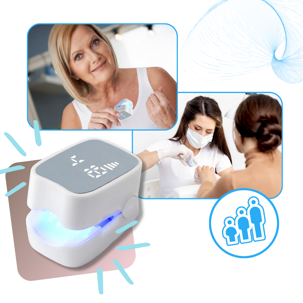 Laser indolore pour les mycoses des ongles