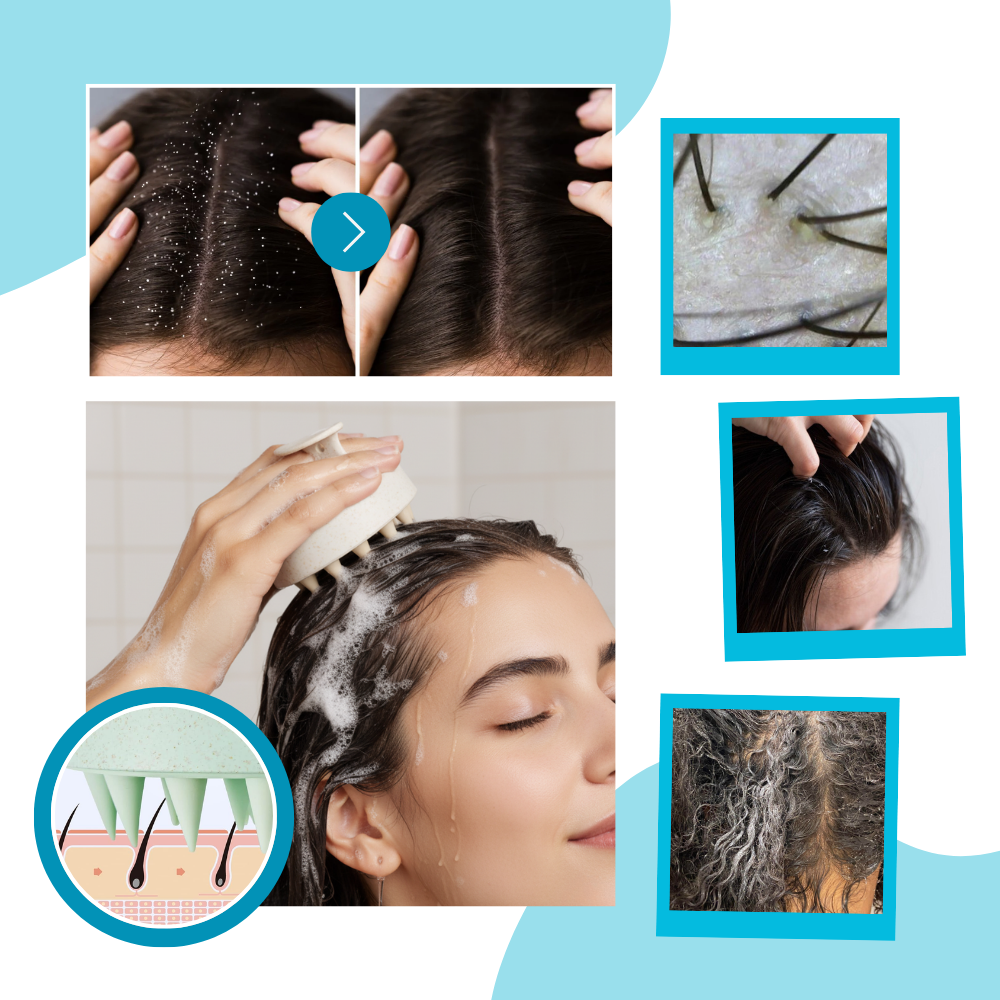 Brosse de massage en silicone pour le cuir chevelu
