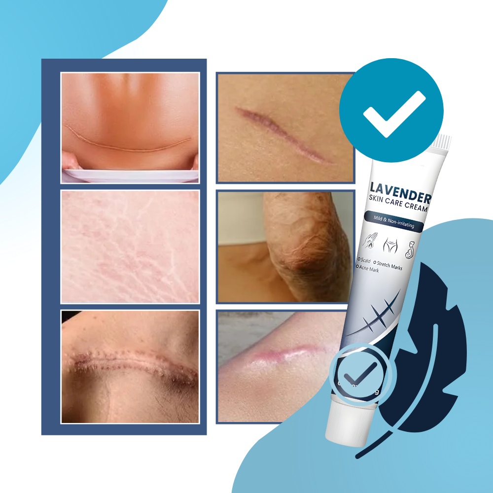 Crème hydratante au silicone pour cicatrices de grossesse