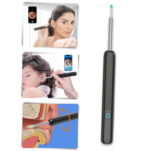 Caméra de nettoyage d'oreille pour retirer le cérumen