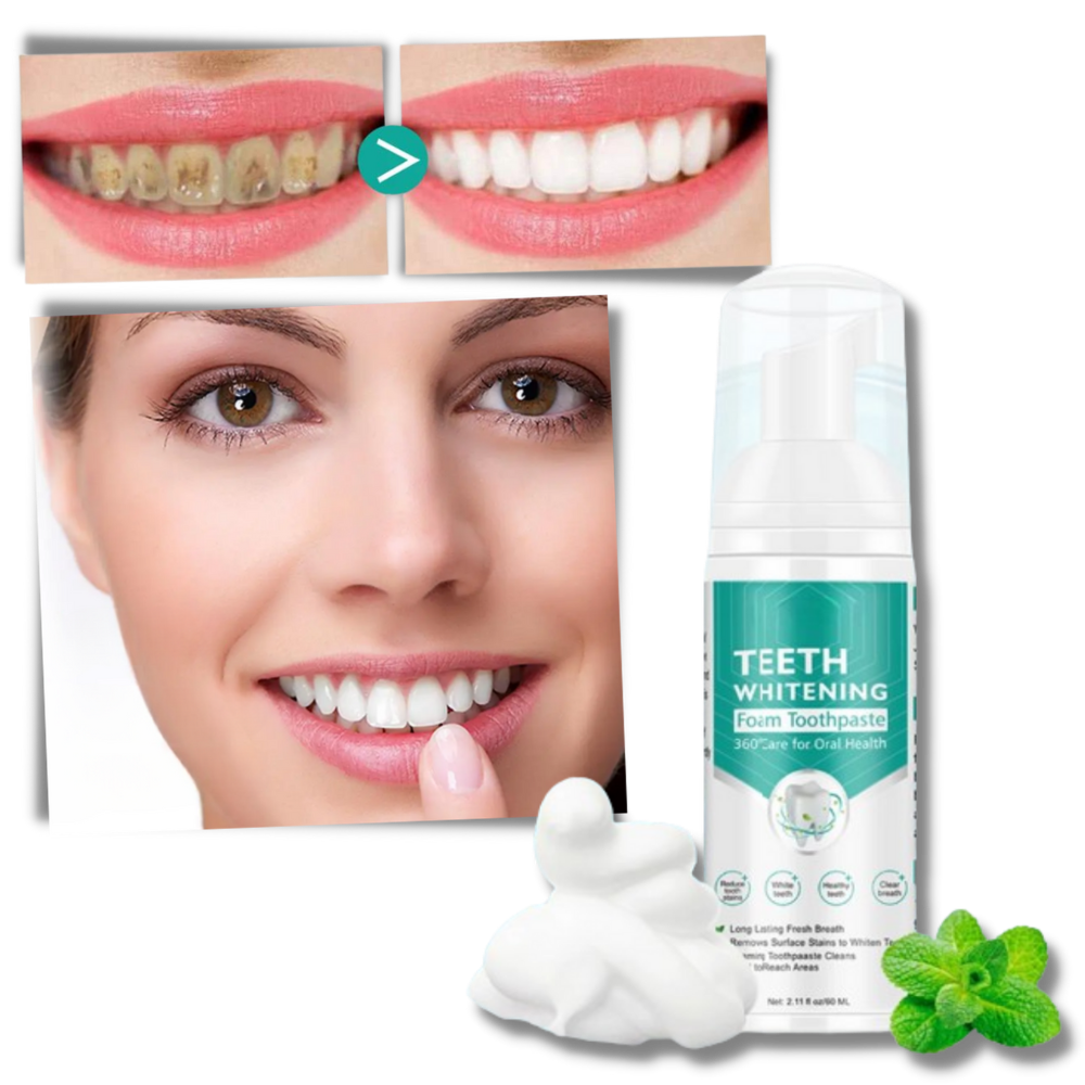 Mousse blanchissante pour les dents